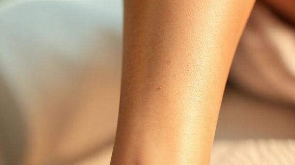 Les vérités sur l'épilation laser : mythe ou réelle durabilité ?